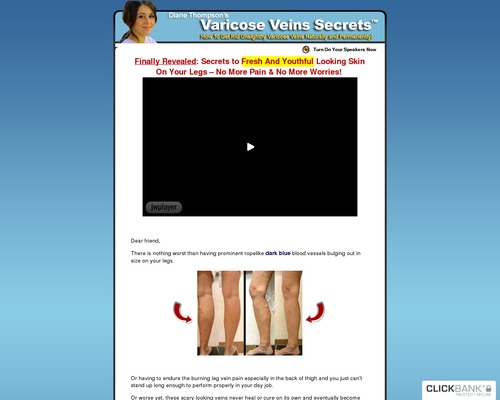 Get Rid Varicose Veins Naturally ** Hot Niche – 70%/Sale